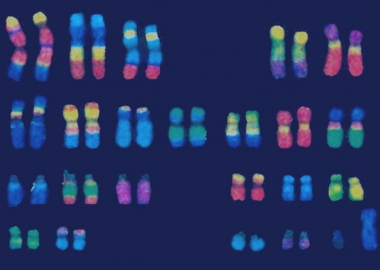 დაუნის სინდრომის დღე