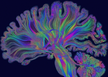 როგორ ავიცილოთ ტვინის ადრეული დაბერება