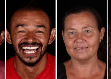 ბრაზილიელი სტომატოლოგი ღარიბ მოსახლეობას უფასო მომსახურებას სთავაზობს