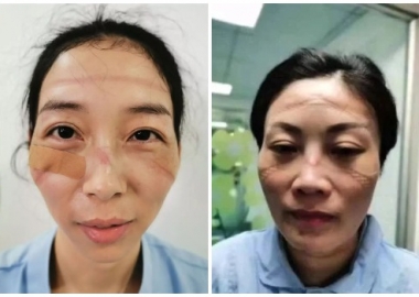 ჩინელი მედპერსონალი კორონავირუსთან ბრძოლის პირველ ხაზზე