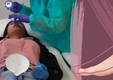 "COVID-ის ფეხის თითები" - კორონავირუსის ახალი სიმპტომი?